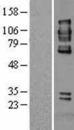 Novus Biologicals&trade;&nbsp;PTP alpha/PTPRA Overexpression Lysate