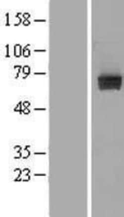 Novus Biologicals™ PTP epsilon Overexpression Lysate