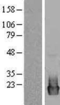 Novus Biologicals&trade;&nbsp;PRL-2/PTP4A2 Overexpression Lysate