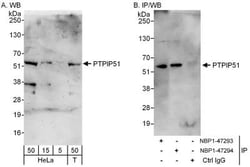 PTPIP51 Antibody, Novus Biologicals 0.1mg; Unlabeled:Antibodies, Polyclonal