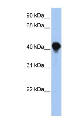 PTPLAD1 Antibody, Novus Biologicals 0.05mg; Unlabeled:Antibodies, Polyclonal