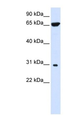 PTPLAD2 Antibody, Novus Biologicals 100&mu;L; Unlabeled:Antibodies, Polyclonal