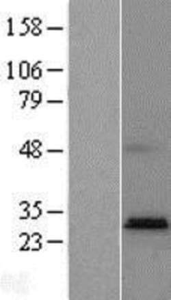 Novus Biologicals&trade;&nbsp;PTPLAD2 Overexpression Lysate