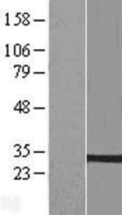 Novus Biologicals&trade;&nbsp;PTPLB Overexpression Lysate