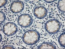 PTP1B/PTPN1 Antibody (OTI1D10), Novus Biologicals 0.1mL; Unlabeled:Antibodies,