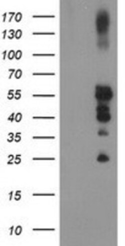 PTP1B/PTPN1 Antibody (OTI1D10), Novus Biologicals 0.1mL; Unlabeled:Antibodies,