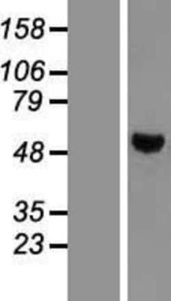 Novus Biologicals&trade;&nbsp;PTP1B/PTPN1 Overexpression Lysate