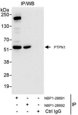 PTP1B/PTPN1 Antibody, Novus Biologicals 0.1mg; Unlabeled:Antibodies, Polyclonal