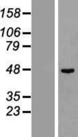 Novus Biologicals TC-PTP/PTPN2 Overexpression Lysate 0.1 mg | Buy Online | Novus Biologicals&trade; | Fisher Scientific