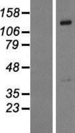 Novus Biologicals&trade;&nbsp;PTPN21 Overexpression Lysate