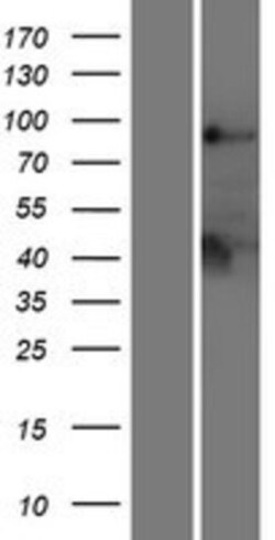 Novus Biologicals&trade;&nbsp;Lyp/PTPN22 Overexpression Lysate