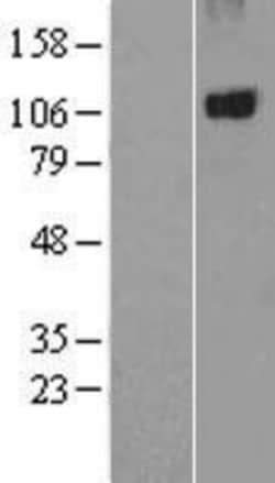 Novus Biologicals&trade;&nbsp;PTPN3 Overexpression Lysate