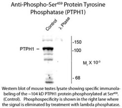 PTPN3, p Ser459 Antibody, Novus Biologicals 0.1mL; Unlabeled:Antibodies,