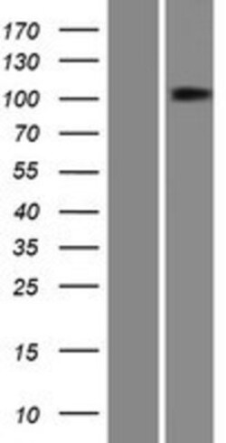 Novus Biologicals™ PTPN4 Overexpression Lysate