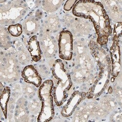 PTPN4 Antibody, Novus Biologicals 0.1 mL | Buy Online | Novus Biologicals | Fisher Scientific