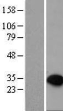 Novus Biologicals&trade;&nbsp;PTPRCAP Overexpression Lysate