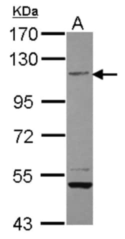 PTPRH Antibody, Novus Biologicals 0.1 mL | Buy Online | Novus Biologicals | Fisher Scientific