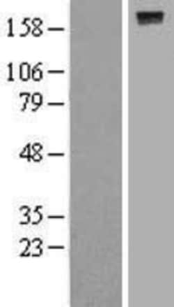 Novus Biologicals&trade;&nbsp;DEP-1/CD148 Overexpression Lysate