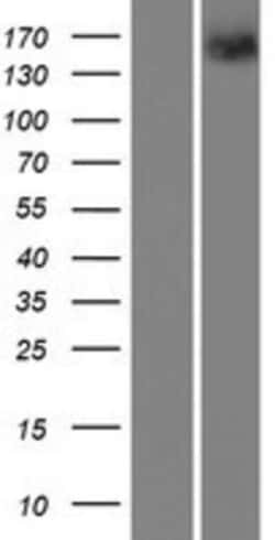 Novus Biologicals™ PTP rho/PTPRT Overexpression Lysate