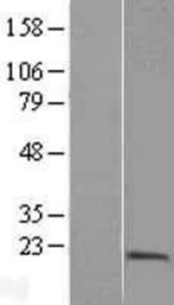 Novus Biologicals&trade;&nbsp;PTRH2 Overexpression Lysate