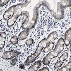 PTRHD1 Antibody, Novus Biologicals 0.1mL; Unlabeled:Antibodies, Polyclonal