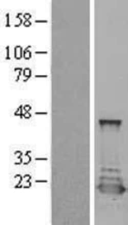 Novus Biologicals&trade;&nbsp;PTS Overexpression Lysate