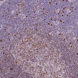 PU.1/Spi-1 Antibody, Novus Biologicals 0.1mL; Unlabeled:Antibodies, Polyclonal