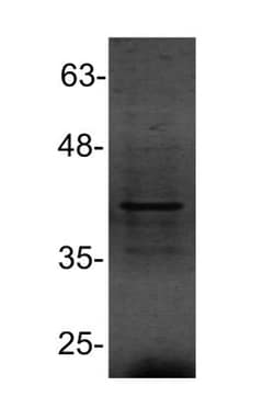 PU.1/Spi-1 Antibody, Novus Biologicals:Antibodies:Primary Antibodies