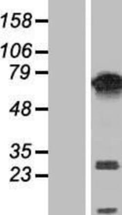 Novus Biologicals™ PUF60 Overexpression Lysate