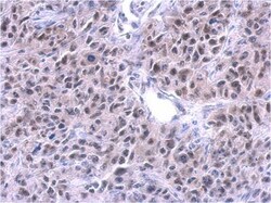 PUF60 Antibody (3510), Novus Biologicals 0.1mL; Unlabeled:Antibodies, Monoclonal
