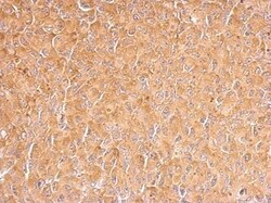 PUM2 Antibody, Novus Biologicals 0.1mL; Unlabeled:Antibodies, Polyclonal