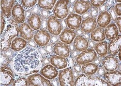 PUM2 Antibody, Novus Biologicals 0.1mL; Unlabeled:Antibodies, Polyclonal