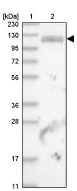 PUM2 Antibody, Novus Biologicals:Antibodies:Primary Antibodies