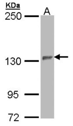 PUM2 Antibody, Novus Biologicals 0.1mL; Unlabeled:Antibodies, Polyclonal