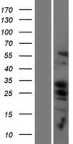 Novus Biologicals&trade;&nbsp;PUMA Overexpression Lysate