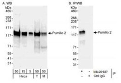 PUM2 Antibody, Novus Biologicals 0.1mg; Unlabeled:Antibodies, Polyclonal