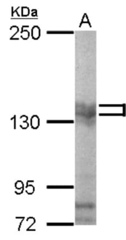 PUM2 Antibody, Novus Biologicals 0.1mL; Unlabeled:Antibodies, Polyclonal