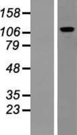 Novus Biologicals™ PUM2 Overexpression Lysate
