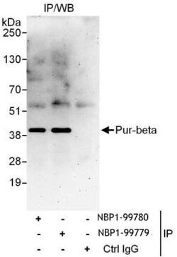 PURB Antibody, Novus Biologicals 0.1mg; Unlabeled:Antibodies, Polyclonal