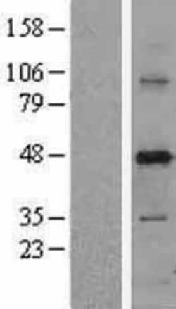 Novus Biologicals&trade;&nbsp;PUS1 Overexpression Lysate