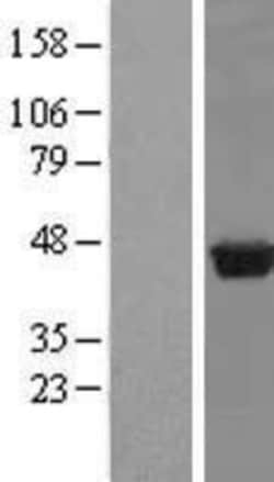Novus Biologicals&trade;&nbsp;PUS1 Overexpression Lysate