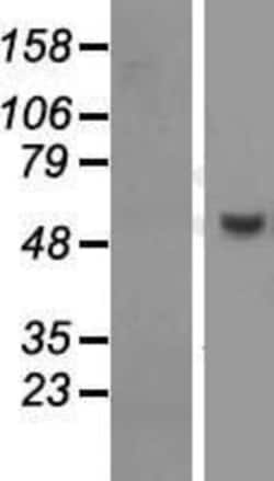 Novus Biologicals&trade;&nbsp;PUS10 Overexpression Lysate