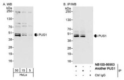 PUS1 Antibody, Novus Biologicals 0.1mL; Unlabeled:Antibodies, Polyclonal