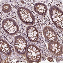 PUS7L Antibody, Novus Biologicals 0.1mL; Unlabeled:Antibodies, Polyclonal
