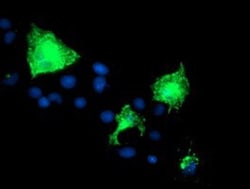 Nectin-1/PVRL1 Antibody (OTI6F8), Novus Biologicals 0.1mL; Unlabeled:Antibodies,