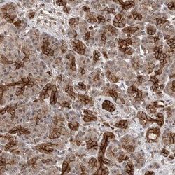 OTUD6B Antibody, Novus Biologicals:Antibodies:Primary Antibodies