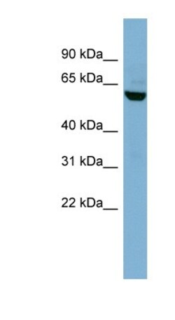 Nectin-3/PVRL3 Antibody, Novus Biologicals:Antibodies:Primary Antibodies