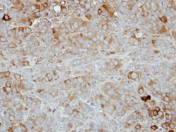 Nectin-4/PVRL4 Antibody, Novus Biologicals 0.1mL; Unlabeled:Antibodies,