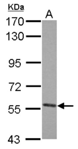 Nectin-4/PVRL4 Antibody, Novus Biologicals 0.1mL; Unlabeled:Antibodies,
