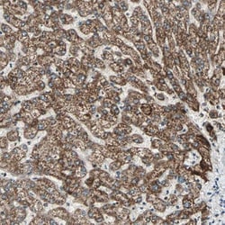 PX19 Antibody, Novus Biologicals:Antibodies:Primary Antibodies